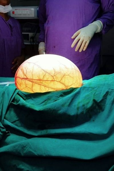 Best Fertility Center in Ariyalur