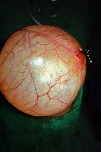 Best Fertility Center in Ariyalur